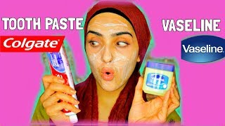 I APPLIED TOOTHPASTE AND VASELINE ON MY FACE  Look What Happened   Immy [upl. by Shamus693]