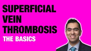 Superficial Vein Thrombophlebitis  The Essentials [upl. by Resee]