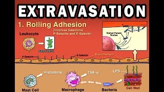 EXTRAVASATION [upl. by Aveline]