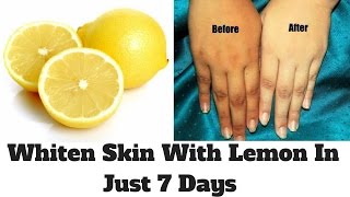 How To Whiten Skin With Lemon In Just 7 Days  Lemon Facial At Home  Lemon For Skin Whitening [upl. by Dorweiler943]