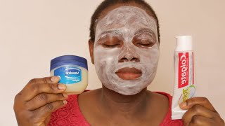 I APPLIED COLGATE TOOTHPASTE AND VASELINE ON MY FACE TO SEE WHAT HAPPENED [upl. by Neelac]