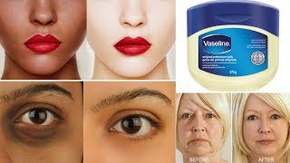 Top 3 Ways To Use Vaseline  Get Fair amp Glowing Skin  Removes Dark Spot Aging Signs amp Dark Circles [upl. by Ainet626]